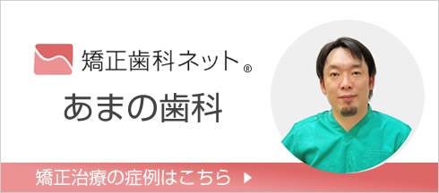 矯正治療の症例はこちら